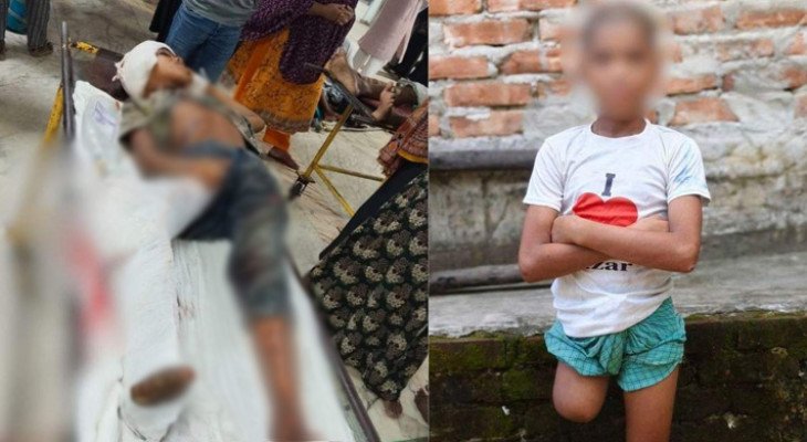 ট্রেন দুর্ঘটনার কারণে পা কাটতে হয়েছিল শিশু রায়হানের, সামনে এলো চাঞ্চল্যকর তথ্য